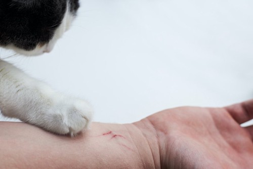 猫の手と傷ついた人の腕