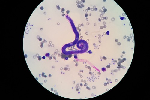 顕微鏡下のフィラリア