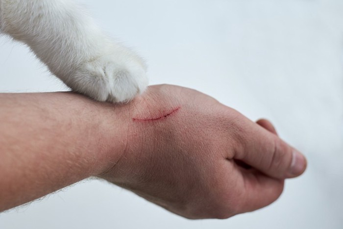 猫の手と引っ掻き傷がある人の手