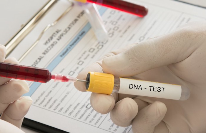 遺伝子検査の試験管