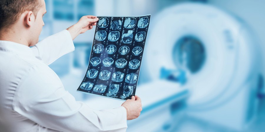 MRI画像を見る研究者