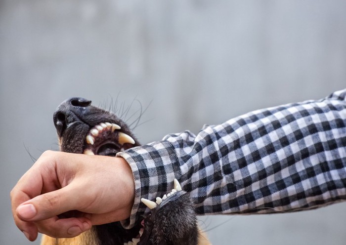 腕を噛む犬